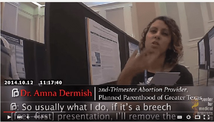 New video confirms illegal abortion methods used by Planned Parenthood