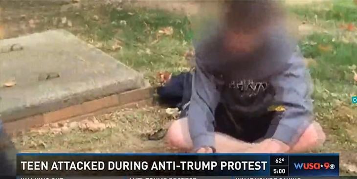 Maryland Teen Beaten At School Sanctioned Anti-Trump Demonstration