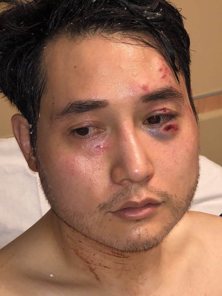 Andy Ngo's Attorney Plans to "Sow Salt" Into Antifa's "Yoga Studios and Avocado Toast Stands"