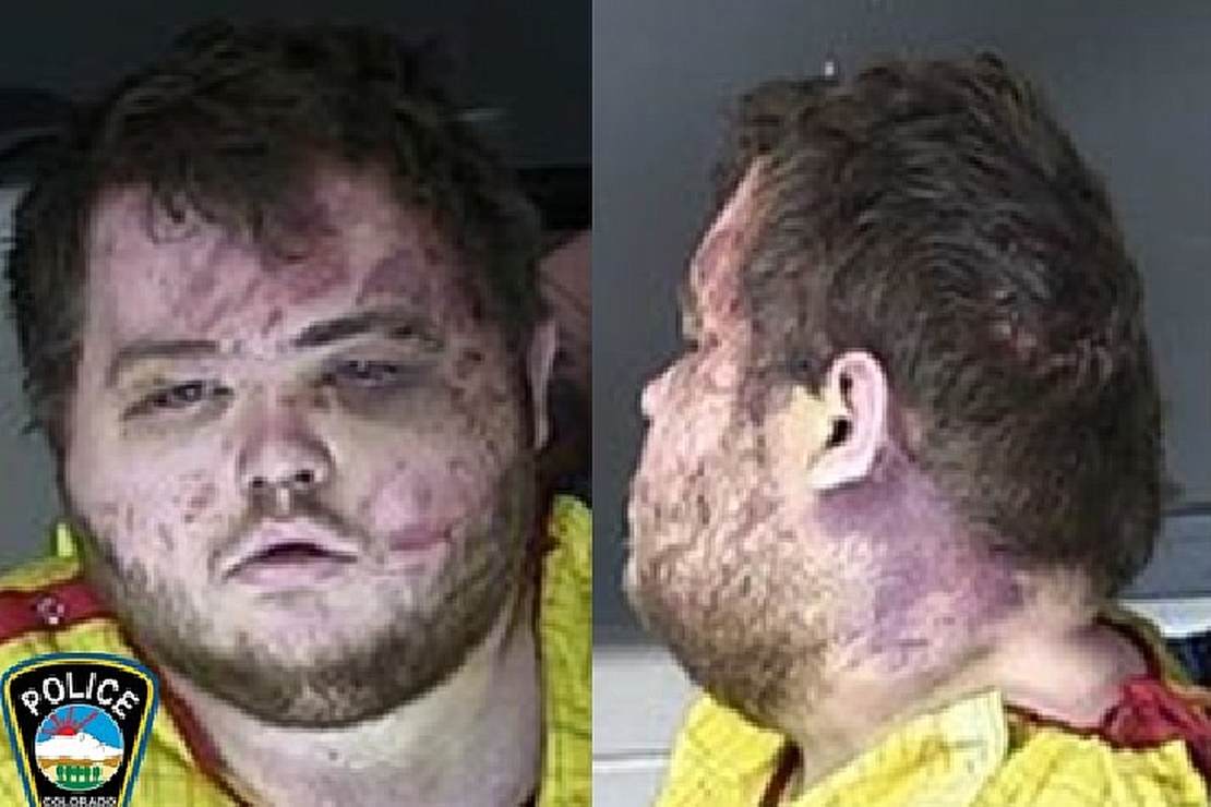 Colorado Shooting Suspect's Mugshot Released, Can Barely Speak at First Court Appearance