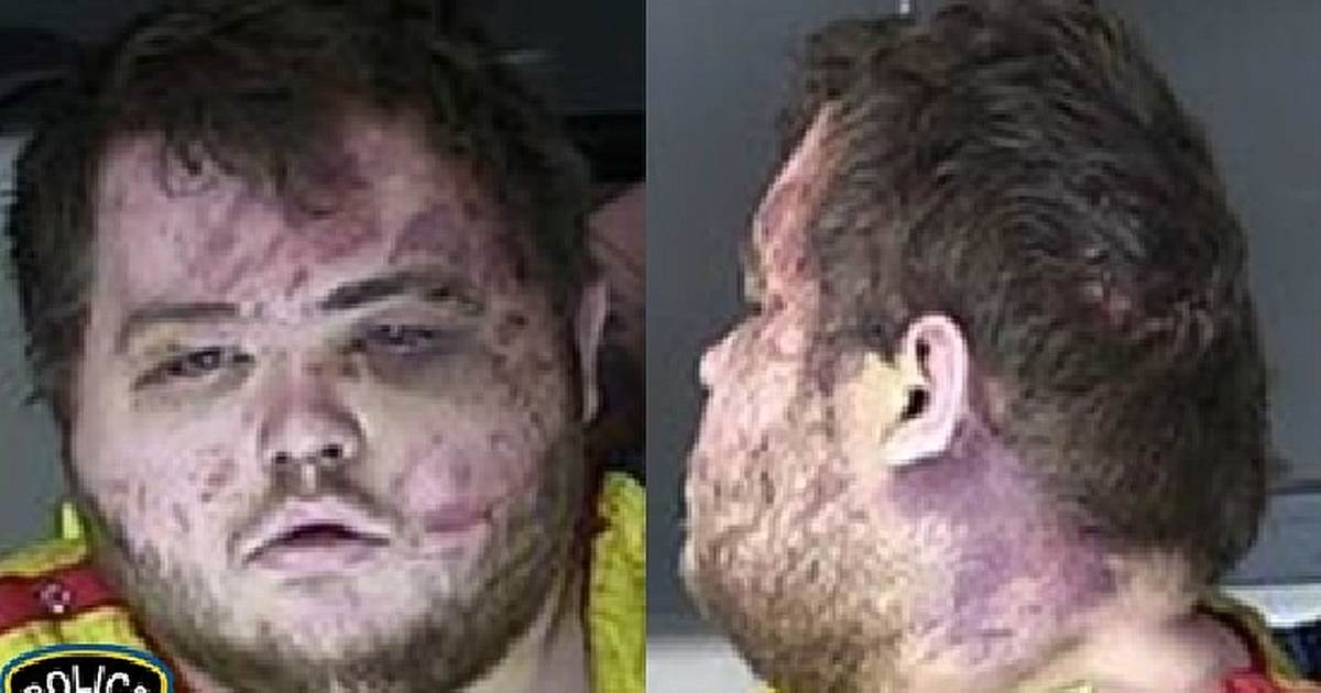 Colorado shooting suspect Anderson Aldrich